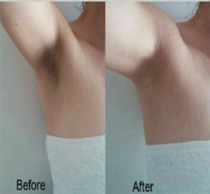 Qraa underarm whitening cream | Review for dark underarms @ Best Price in India